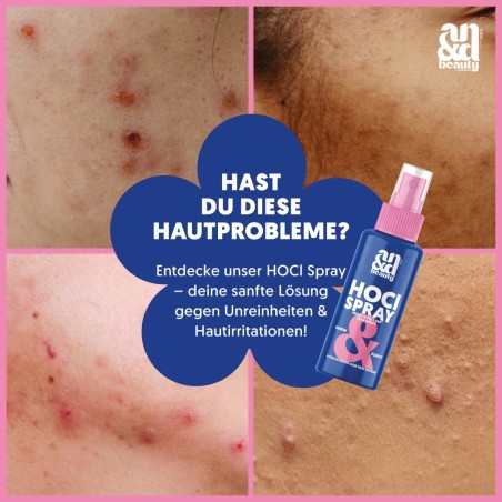 HOCl Spray Mini Home & Go Set (100 ml + 30 ml)